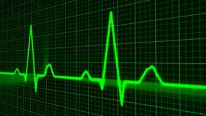 Pulse trace heartbeat EKG