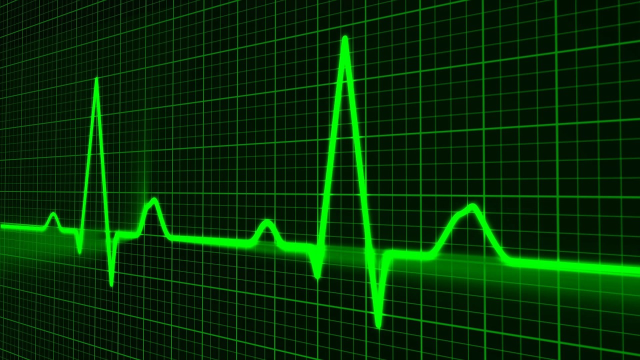 Pulse trace heartbeat EKG